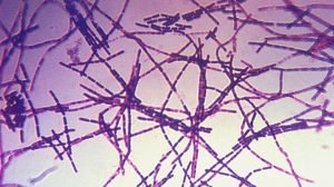 Bacillum anthracis